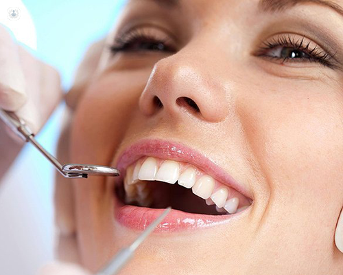 Enhance Your Smile and Confidence with Permanent Dentures in Tampa