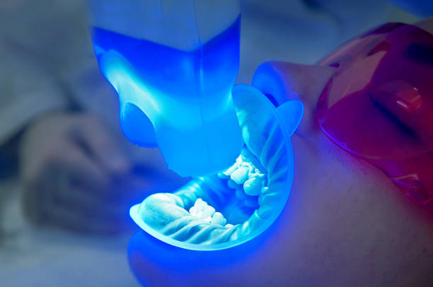 Luminous Grins: Top Teeth Whitening Choices in Riyadh